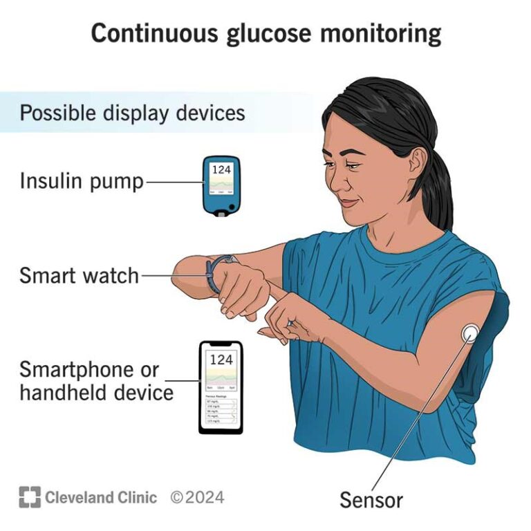 Decoding Wellness: My Experiment with Continuous Glucose Monitoring